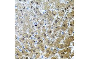 Immunohistochemistry of paraffin-embedded human liver injury using RNF166 antibody. (RNF166 anticorps)
