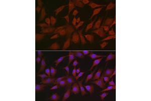 Immunofluorescence analysis of NIH/3T3 cells using EIF4ENIF1 Rabbit pAb (ABIN7267051) at dilution of 1:100 (40x lens).