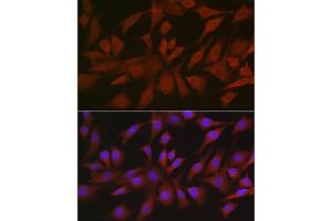 Immunofluorescence analysis of NIH/3T3 cells using EIF4ENIF1 Rabbit pAb (ABIN7267051) at dilution of 1:100 (40x lens). (EIF4ENIF1 anticorps  (AA 150-250))