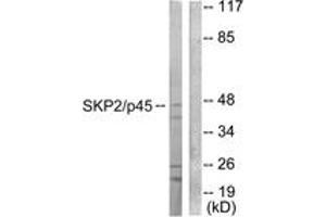 Western blot analysis of extracts from 293 cells, using SKP2/p45 Antibody. (SKP2 anticorps  (AA 366-415))