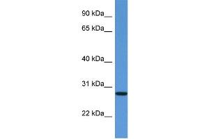 WB Suggested Anti-EDN3 Antibody Titration: 1.