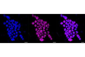anti-Proteasome (Prosome, Macropain) 26S Subunit, ATPase, 5 (PSMC5) antibody