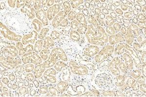 Immunohistochemical analysis of paraffin-embedded Human kidney section using Pink1 A. (BAP1 anticorps  (AA 36-66))