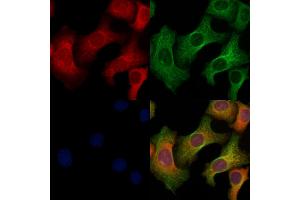 ABIN6264702 and ABIN6269113 staining Hela cells by IF/ICC. (Ret Proto-Oncogene anticorps  (C-Term))