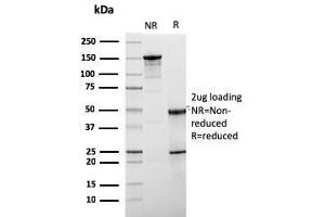 SDS-PAGE Analysis Purified HER-2 Mouse Monoclonal Antibody (ERBB2/3078). (ErbB2/Her2 anticorps  (AA 311-462))