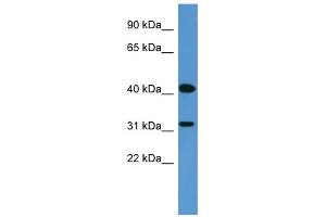 WB Suggested Anti-OR2W1 Antibody Titration: 0. (OR2W1 anticorps  (C-Term))