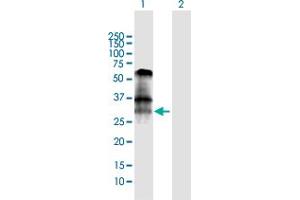 Western Blot analysis of BNIP3 expression in transfected 293T cell line by BNIP3 MaxPab polyclonal antibody. (BNIP3 anticorps  (AA 1-194))