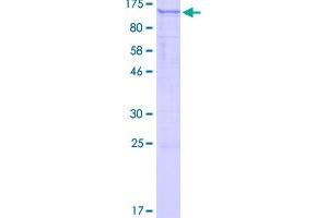 Image no. 1 for Pleckstrin Homology Domain Containing, Family G (With RhoGef Domain) Member 6 (PLEKHG6) (AA 1-790) protein (GST tag) (ABIN1315402)