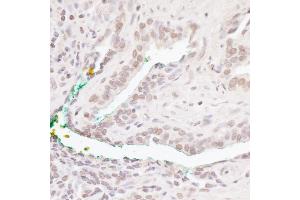 Immunohistochemistry (IHC) image for anti-B-Cell CLL/lymphoma 11B (Zinc Finger Protein) (BCL11B) (C-Term) antibody (ABIN7454622) (BCL11B anticorps  (C-Term))