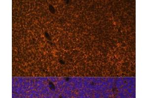 Immunofluorescence analysis of Mouse embryos cells using PTCH1 Polyclonal Antibody at dilution of 1:100.
