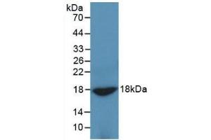 Detection of Recombinant ADP, Rat using Monoclonal Antibody to Adiponectin (ADPN) (ADIPOQ anticorps  (AA 111-244))