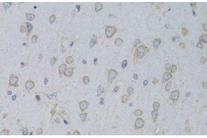 Immunohistochemistry of paraffin-embedded Rat brain using GARS Polyclonal Antibody at dilution of 1:100 (40x lens).