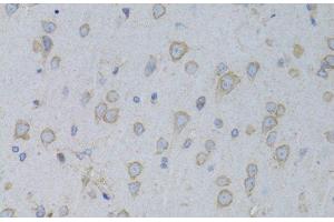 Immunohistochemistry of paraffin-embedded Rat brain using GARS Polyclonal Antibody at dilution of 1:100 (40x lens). (GARS anticorps)