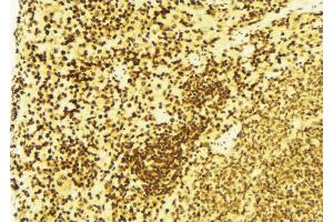 ABIN6269395 at 1/100 staining Mouse spleen tissue by IHC-P.
