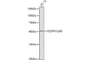 Western blot analysis of extracts of PC-12 cells, using SQSTM1/p62 antibody (ABIN7270205) at 1:1000 dilution.