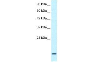 WB Suggested Anti-UBE2N  Antibody Titration: 1. (UBE2N anticorps  (Middle Region))