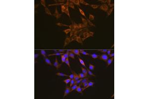 Immunofluorescence analysis of NIH/3T3 cells using VEGFR1 antibody (ABIN1683256, ABIN3015026, ABIN3015027 and ABIN6213602) at dilution of 1:100.