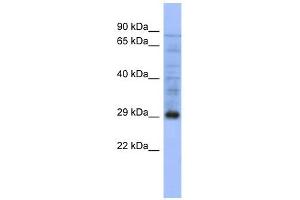 PSMA5 antibody used at 1 ug/ml to detect target protein.