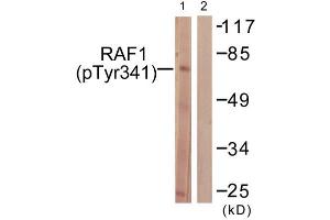 Western Blotting (WB) image for anti-V-Raf-1 Murine Leukemia Viral Oncogene Homolog 1 (RAF1) (pTyr341) antibody (ABIN1847298) (RAF1 anticorps  (pTyr341))