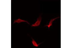 ABIN6274142 staining HuvEc by IF/ICC.