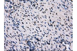 Immunohistochemical staining of paraffin-embedded liver tissue using anti-RPA2 mouse monoclonal antibody. (RPA2 anticorps)