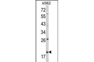 Western blot analysis of KLRD1 Antibody (N-term) (ABIN652571 and ABIN2842384) in K562 cell line lysates (35 μg/lane). (CD94 anticorps  (N-Term))