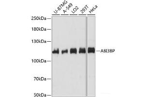 Western blot analysis of extracts of various cell lines using ABI3BP Polyclonal Antibody at dilution of 1:1000. (ABI3BP anticorps)