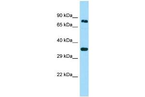 WB Suggested Anti-HOOK3 Antibody Titration: 1. (HOOK3 anticorps  (C-Term))