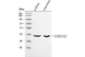 Western blot analysis of ST8SIA2 using anti-ST8SIA2 antibody (ABIN7602297).