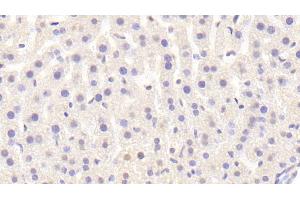 Detection of Raftlin in Mouse Liver Tissue using Polyclonal Antibody to Raft Linking Protein (Raftlin)