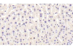 Detection of Raftlin in Mouse Liver Tissue using Polyclonal Antibody to Raft Linking Protein (Raftlin)