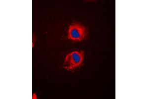 Immunofluorescent analysis of EPS8L2 staining in HeLa cells.