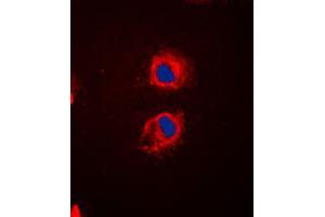 Immunofluorescent analysis of EPS8L2 staining in HeLa cells.