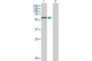 Lane 1: C1S transfected lysate ( 76.