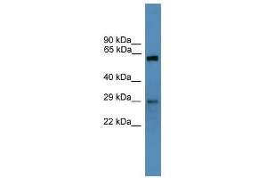 Western Blot showing TP53RK antibody used at a concentration of 1-2 ug/ml to detect its target protein.
