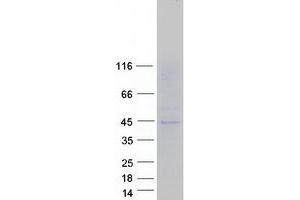 Validation with Western Blot