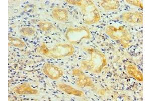 Immunohistochemistry of paraffin-embedded human kidney tissue using ABIN7168971 at dilution of 1:100 (SRSF4 anticorps  (AA 1-180))