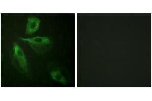 Immunofluorescence analysis of HeLa cells, using ADD1 (Ab-445) Antibody. (alpha Adducin anticorps  (AA 411-460))