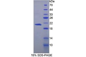 SDS-PAGE analysis of Human Carboxypeptidase N1 Protein. (CPN1 Protéine)