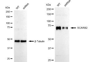 Western blotting analysis using SCARB2 antibody (ABIN7800277). (Recombinant SCARB2 anticorps)
