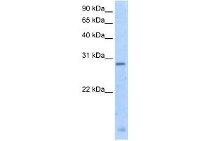 WB Suggested Anti-RGS18 Antibody Titration:  5.