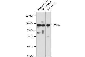Western blot analysis of extracts of various cell lines, using PATL1 antibody (ABIN6293952) at 1:3000 dilution. (PATL1 anticorps)