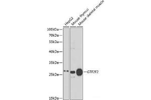 Western blot analysis of extracts of various cell lines using GTF2F2 Polyclonal Antibody at dilution of 1:1000. (GTF2F2 anticorps)