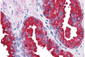 Human Prostate: Formalin-Fixed, Paraffin-Embedded (FFPE)