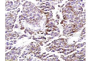 Formalin-fixed and paraffin embedded rat testis tissue labeled with Anti-mTOR Polyclonal Antibody, Unconjugated (ABIN676403) at 1:200 followed by conjugation to the secondary antibody, Goat Anti-Rabbit IgG, PE conjugated and DAPI staining (MTOR anticorps  (AA 2436-2492))