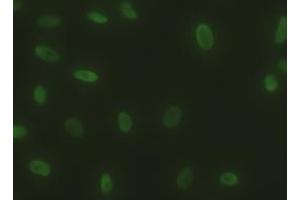 Immunofluorescent staining of HeLa cells using anti-SOX17 mouse monoclonal antibody (ABIN2452369). (SOX17 anticorps  (AA 177-414))
