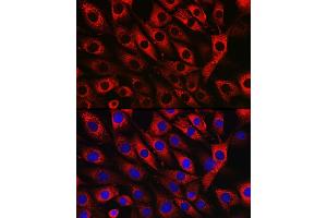 anti-UFM1-Specific Ligase 1 (UFL1) antibody