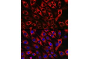 Immunofluorescence analysis of NIH/3T3 cells using UFL1 Rabbit pAb (ABIN7271213) at dilution of 1:50 (40x lens). (UFL1 anticorps)