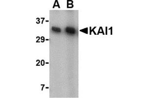 Western Blotting (WB) image for anti-CD82 (CD82) (C-Term) antibody (ABIN1030462) (CD82 anticorps  (C-Term))