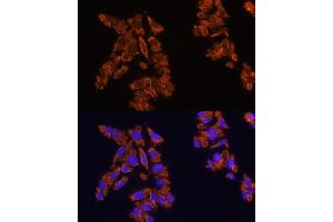 Immunofluorescence analysis of U2OS cells using CD172a/SIRPα Rabbit pAb (ABIN6130058, ABIN6147780, ABIN6147781 and ABIN6224854) at dilution of 1:100 (40x lens). (SIRPA anticorps  (AA 395-504))